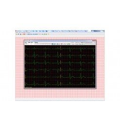 Компьютерный электрокардиограф КРП-01