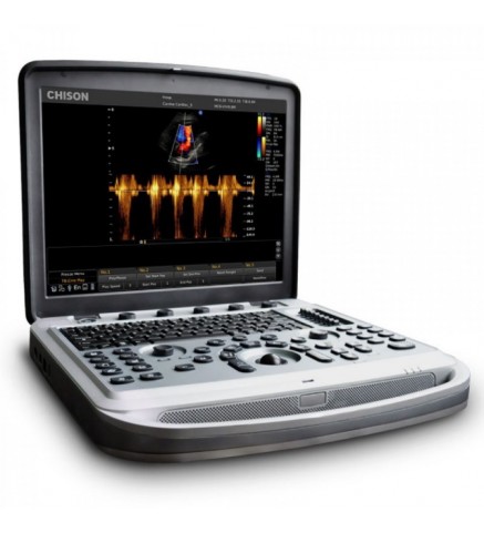 Ультразвуковой сканер SonoTouch 80 (Sonobook 6,8,9)