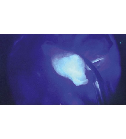 Флуоресцентная визуализация в открытой хирургии VITOM® ICG