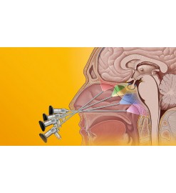 Инструменты KARL STORZ  для эндоназальной хирургии основания черепа