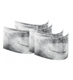 Ортопантомограф цифровой панорамный Pan eXam Plus 3D