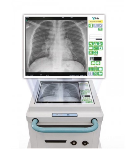Мобильный рентгеновский аппарат MATRIX DR