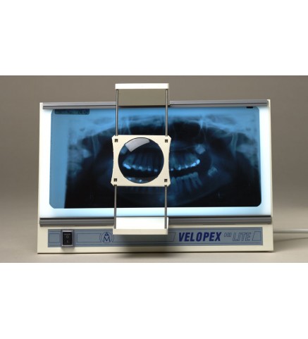 Негатоскоп стоматологический Velopex Hi Lite Viewer