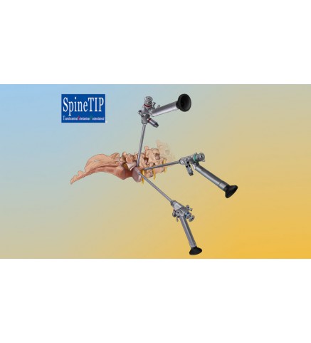 SpineTIP система для чрескожной эндоскопической поясничной декомпрессии
