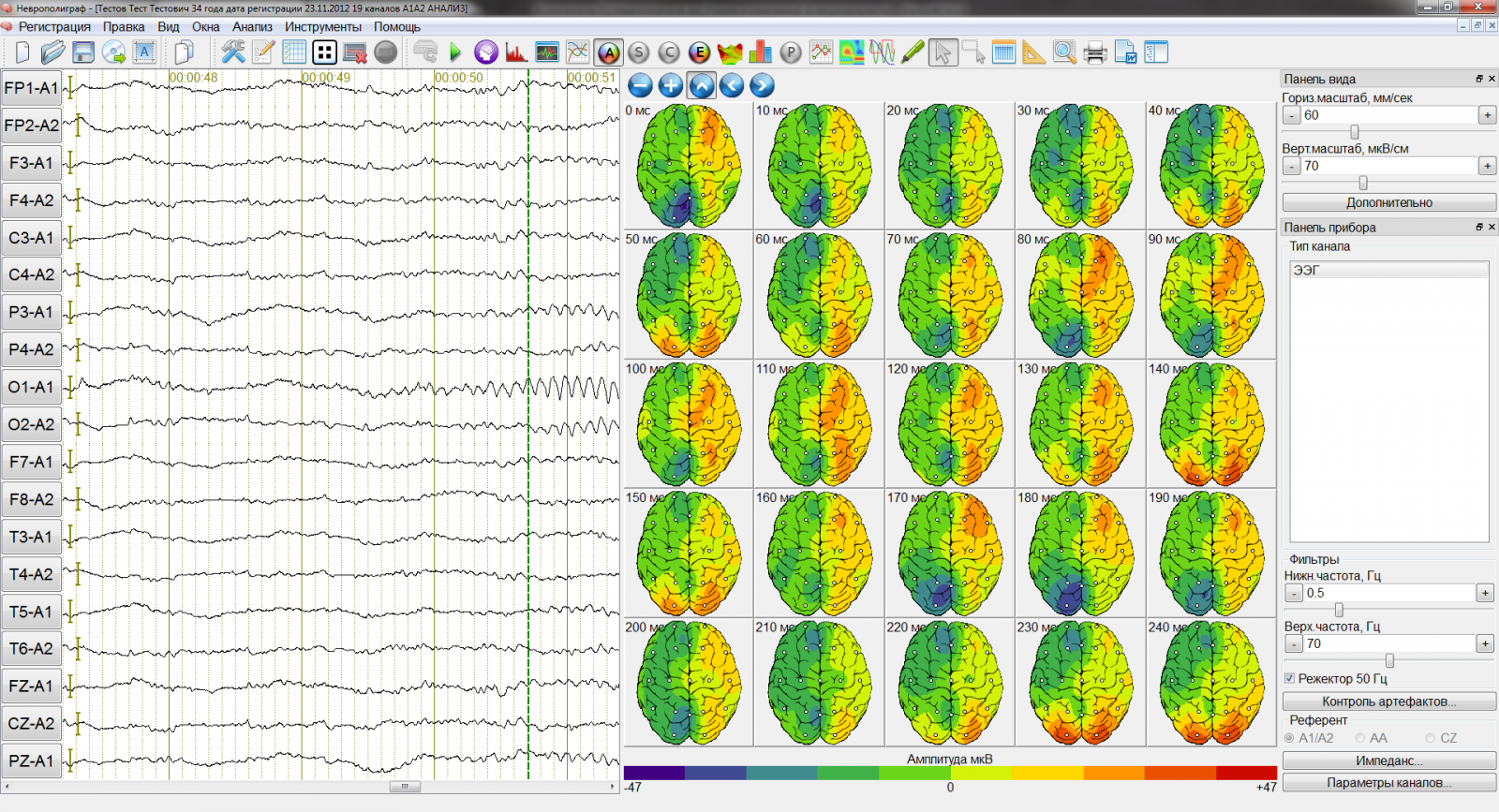 Ээг мозга в спб. ЭЭГ картирование головного мозга. Топографическое картирование электрической активности мозга. Метод картирования ЭЭГ. Картирование электрической активности мозга с помощью ЭЭГ.